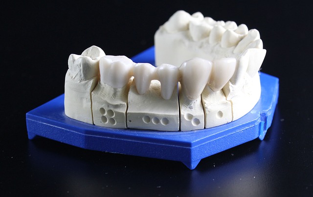 Tooth Replacement Options