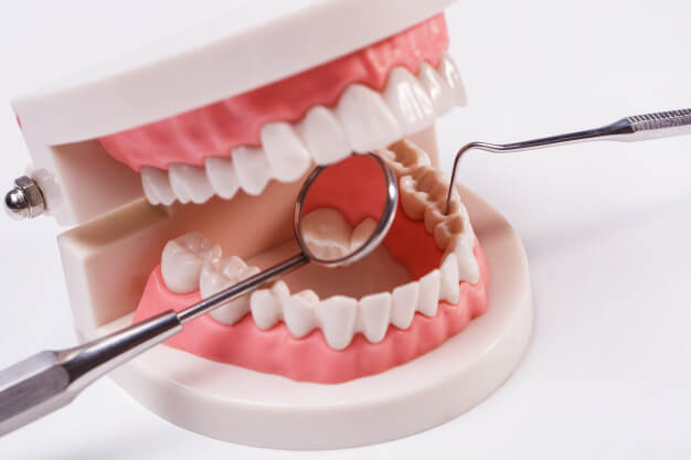 IMPACTION OF WISDOM TEETH