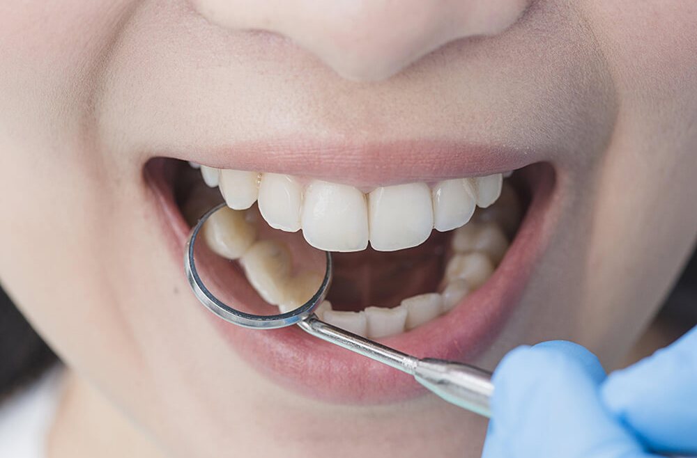 ORAL CANCER
