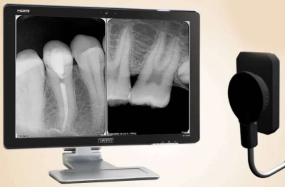 INTRAORAL RADIOGRAPH