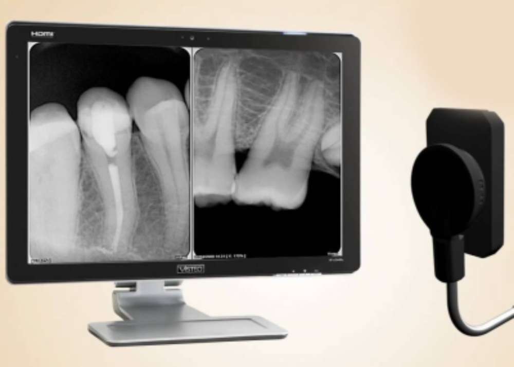INTRAORAL RADIOGRAPH
