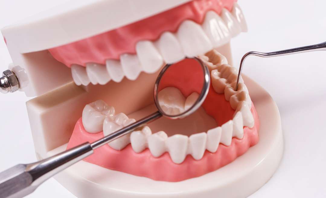 What are the treatment options of gum disease?