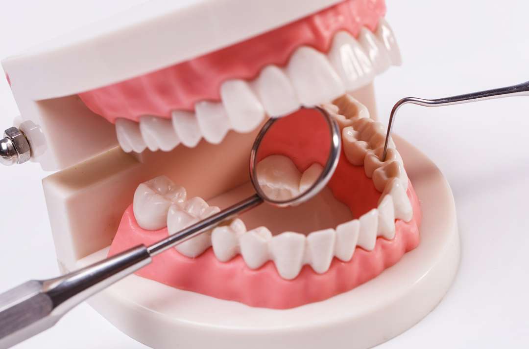 What are the treatment options of gum disease?