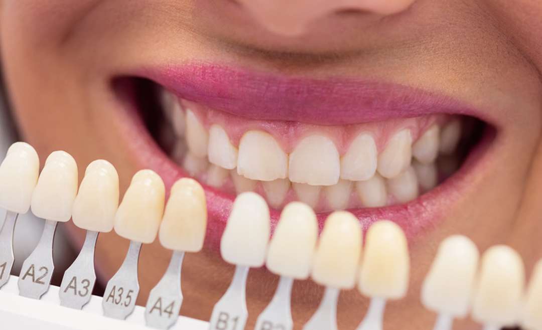 What are the treatment options to restore a tooth lost due to gum disease?