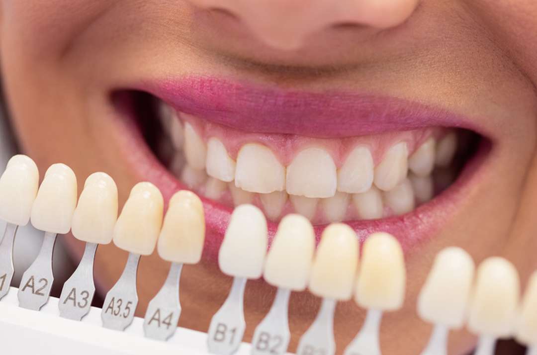What are the treatment options to restore a tooth lost due to gum disease?